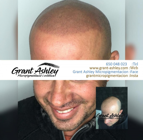 Foto Grant Ashley